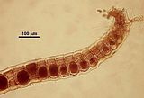 7 - Tetrasporocisti negli articoli apical e subapicali  di un asse ad accrescimento determinato
